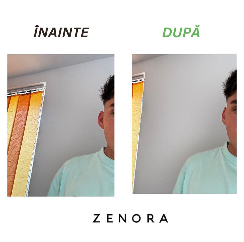 Orelis - Set 4 corectori ureche - Zenora