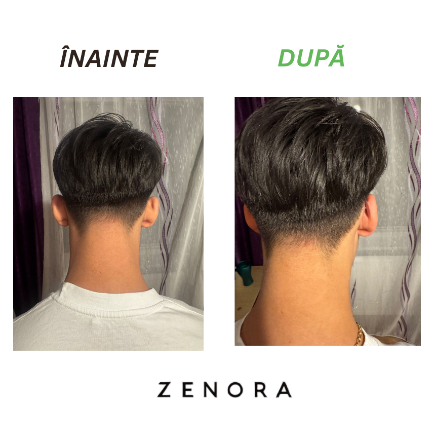 Orelis - Set 4 corectori ureche - Zenora