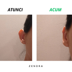 Orelis - Set 4 corectori ureche