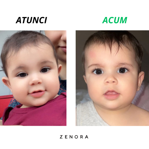 Orelis - Set 4 corectori ureche